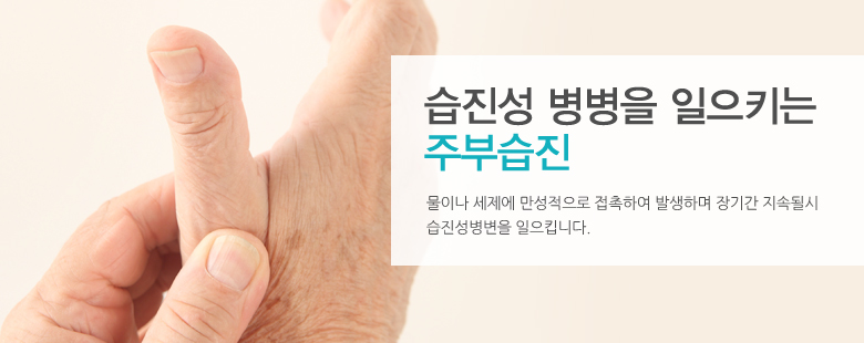습진성 병병을 일으키는 주부습진